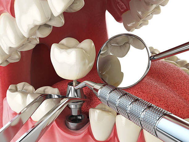 Best Broken Tooth Emergency  in Lutherville, MD